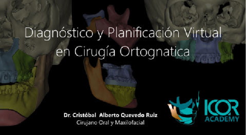 Diagnóstico y planificacion virtual en cirugía ortognática