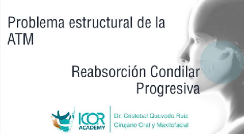 Reabsorción condilar progresiva