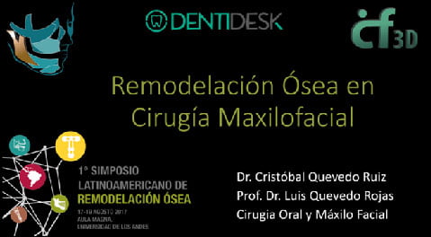 Remodelación ósea en cirugía maxilofacial