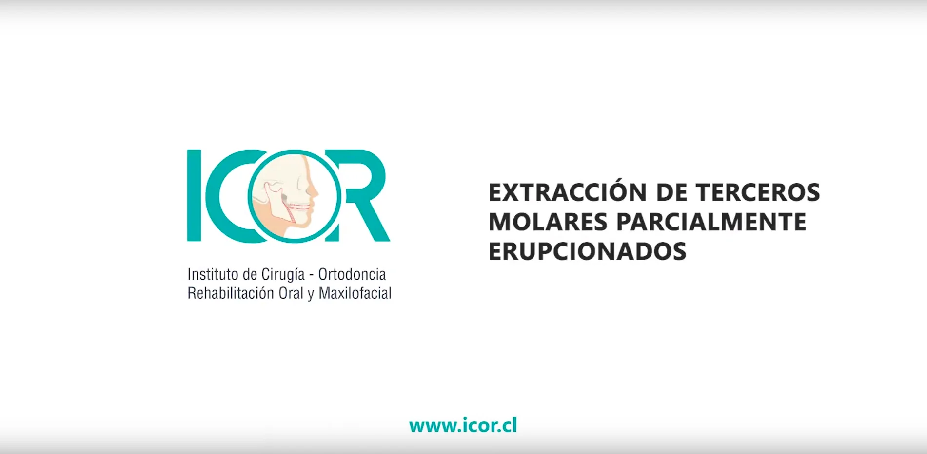 Terceros molares 9 Terceros molares, muelas del juicio, cirugia maxilofacial, cirugia oral, dr. cristóbal quevedo, cirugia bucal, cordales, dentista chile, tercer molar, ortognática, icor, icoracademy, osteotomía