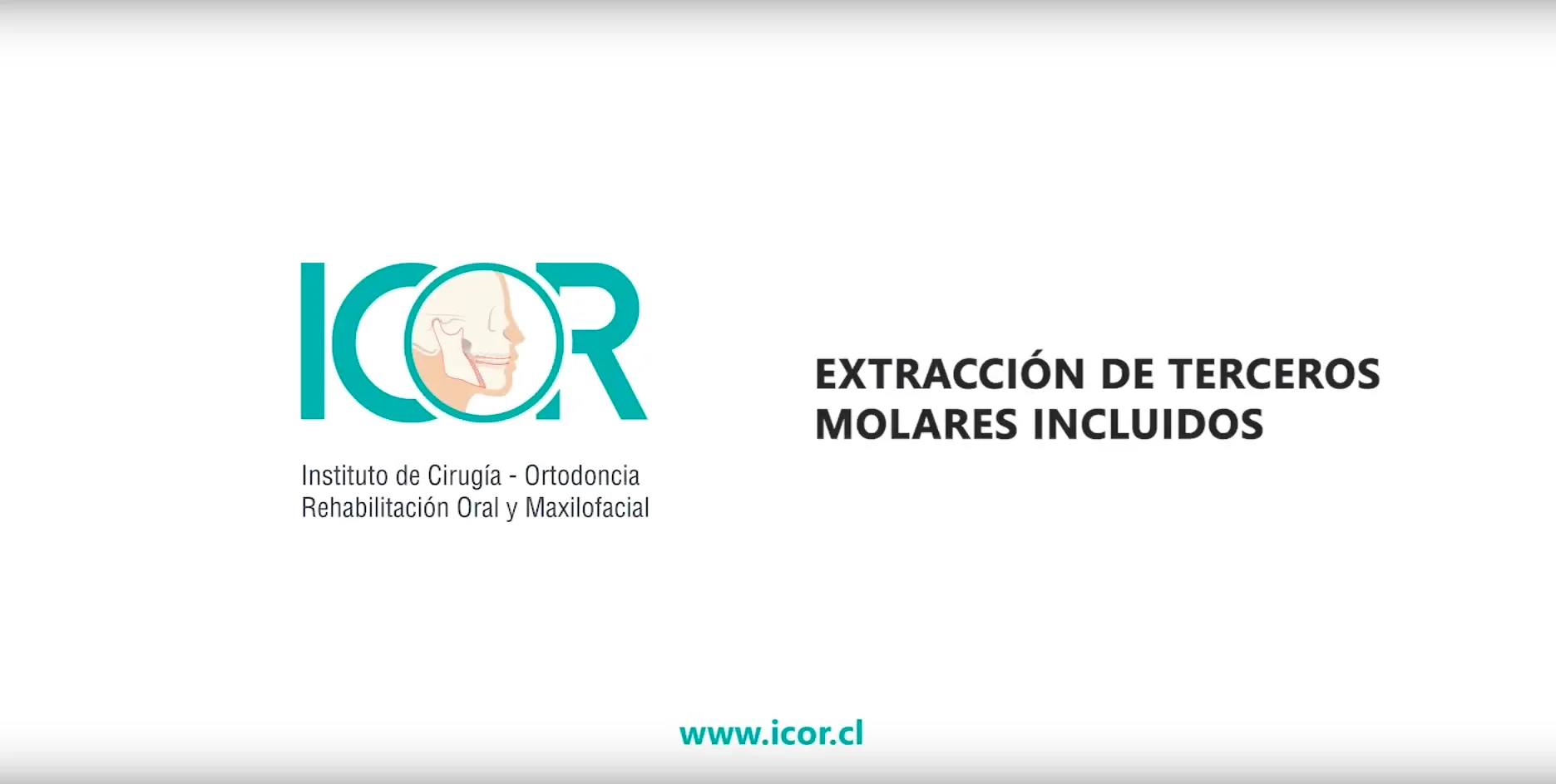 Terceros molares 7 Terceros molares, muelas del juicio, cirugia maxilofacial, cirugia oral, dr. cristóbal quevedo, cirugia bucal, cordales, dentista chile, tercer molar, ortognática, icor, icoracademy, osteotomía