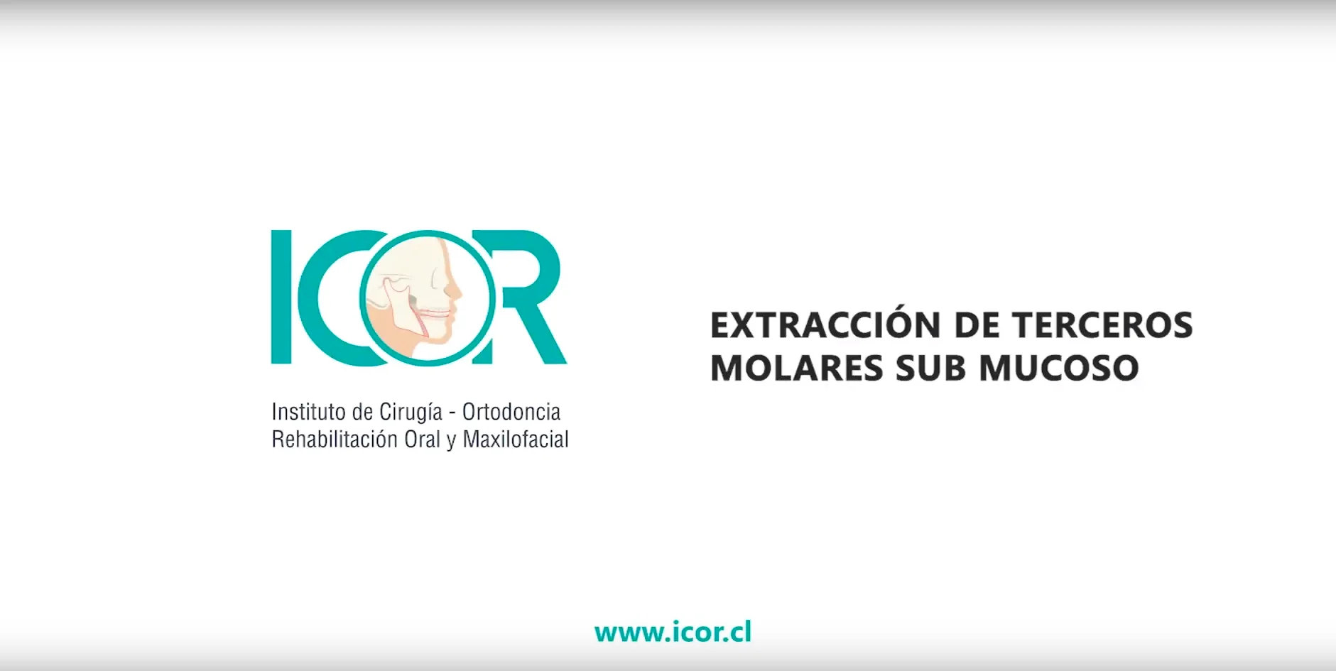 Terceros molares 8 Terceros molares, muelas del juicio, cirugia maxilofacial, cirugia oral, dr. cristóbal quevedo, cirugia bucal, cordales, dentista chile, tercer molar, ortognática, icor, icoracademy, osteotomía