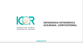 Ortodoncia ostegénica acelerada - Corticotomía - ICOR