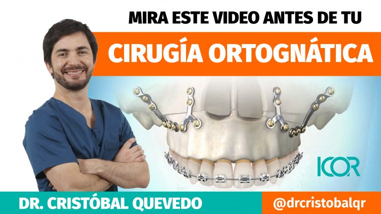 Cirugia ortognática - consulta online