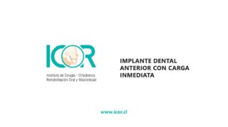 Implante dental anterior carga inmediata