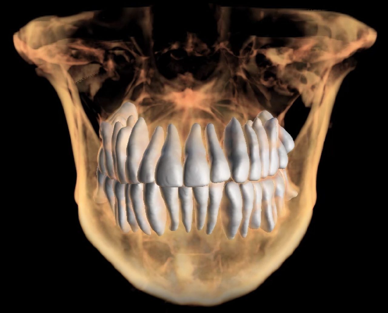 Tomografia de dientes y hueso.