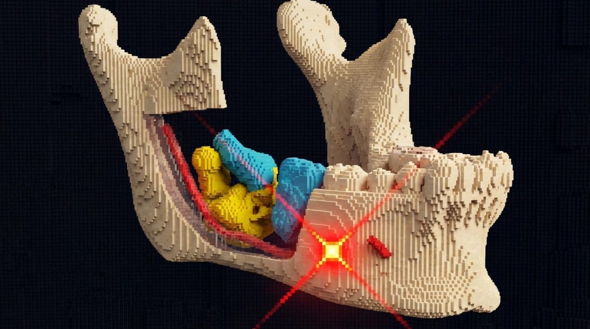 Blog 17 Laser y recuperacion nerviosa