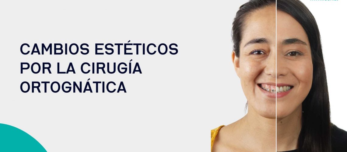 Cambios estéticos cirugia ortognatica
