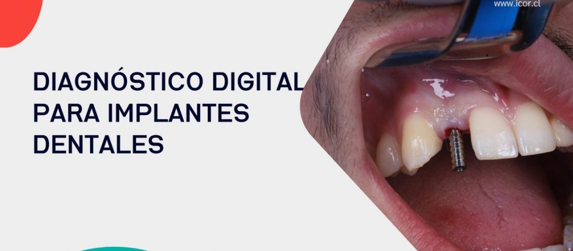 Diagnostico digital para implantes dentales ICOR
