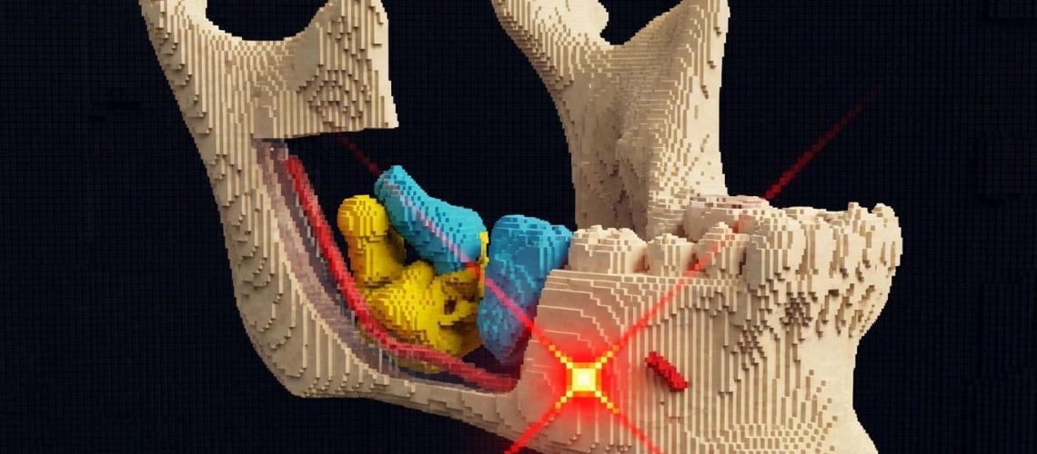 Laser y recuperacion nerviosa