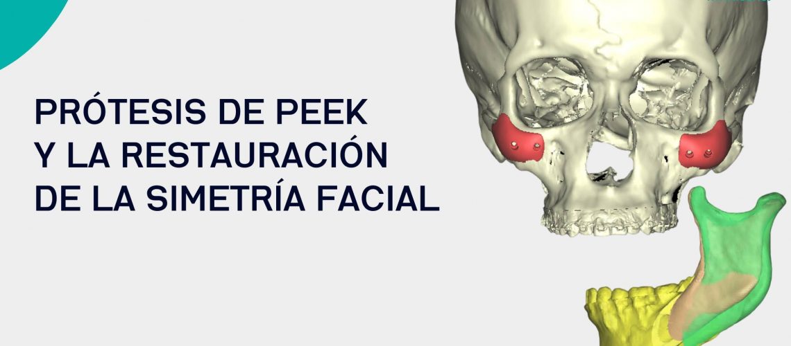Protesis-de-Peek-y-la-restauracion-de-la-simetria-facial