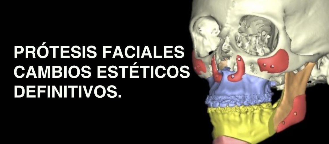 Protesis-faciales-para-cambios-esteticos-en-cirugia-ortognatica