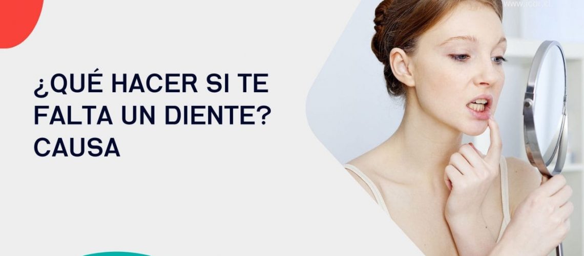 Qué hacer si me falta un diente